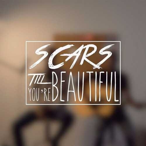 دانلود آهنگ شنیدنی Alessia Cara به نام Scars To Your Beautiful   